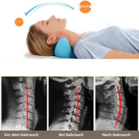 Skanto | Nekra – Ergonomisk Nakke Massasjepute for Komfort og Avslapning