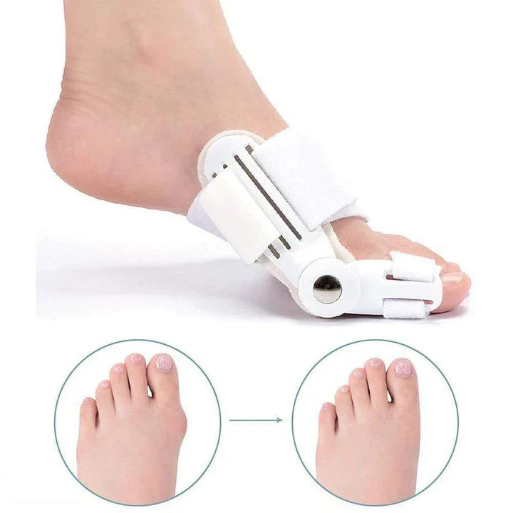 Skanto | Hallux Valgus korreksjons splint (1 par)