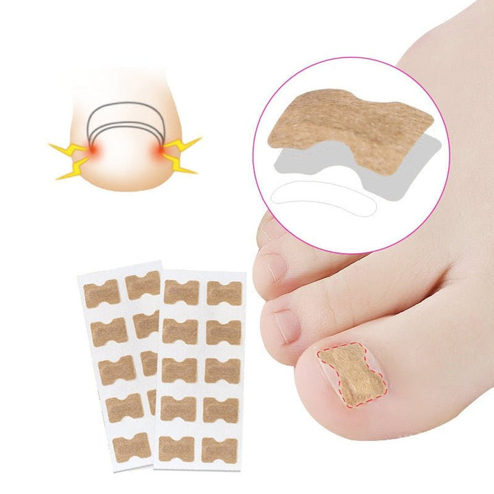 Skanto | Painless Toenail Patch - ToenailExpress
