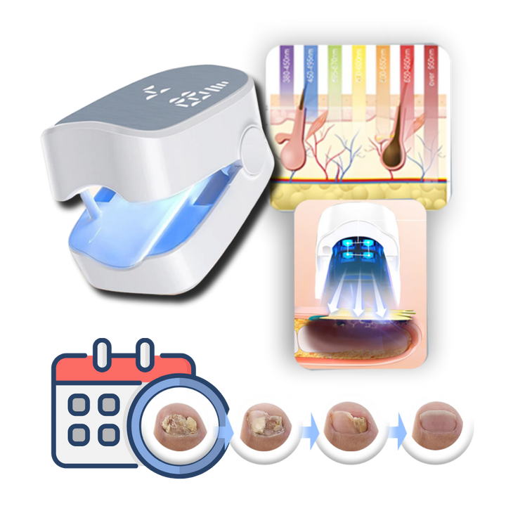 Smertefri Neglesopp-Laser