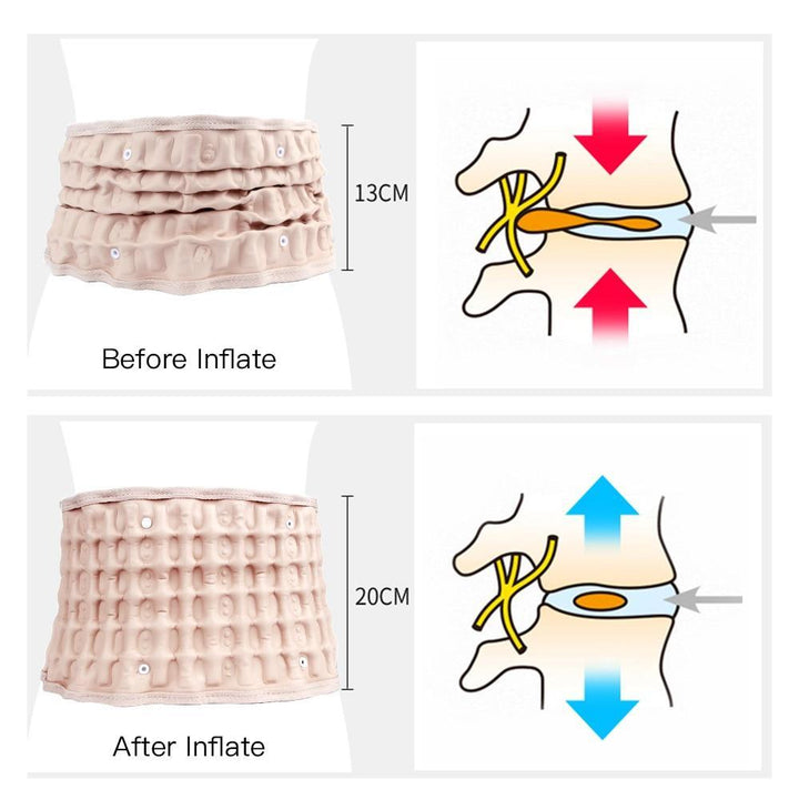 Lumbar Decompression Belt | Skanto