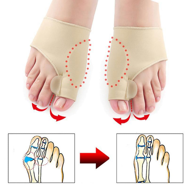 Skanto | Best Bunion Corrector Braces Pads Lindring Behandling Splint